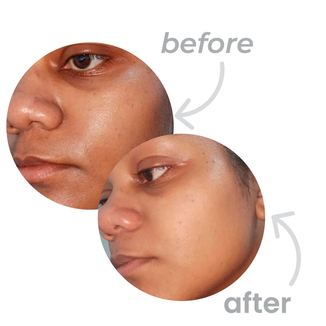Serum facial 5%AHA
