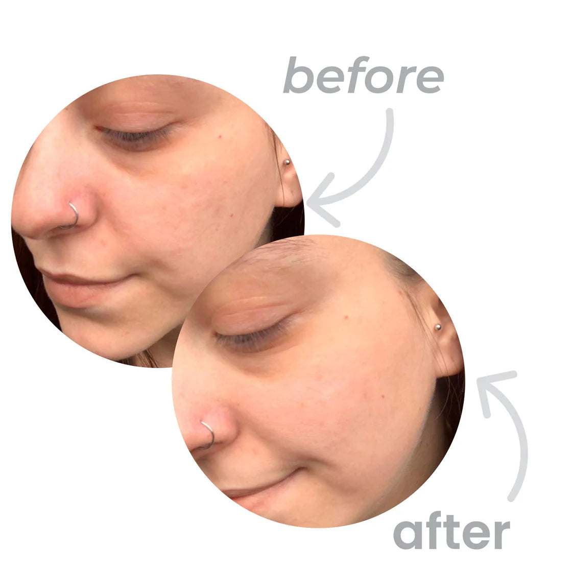 Vitamina C