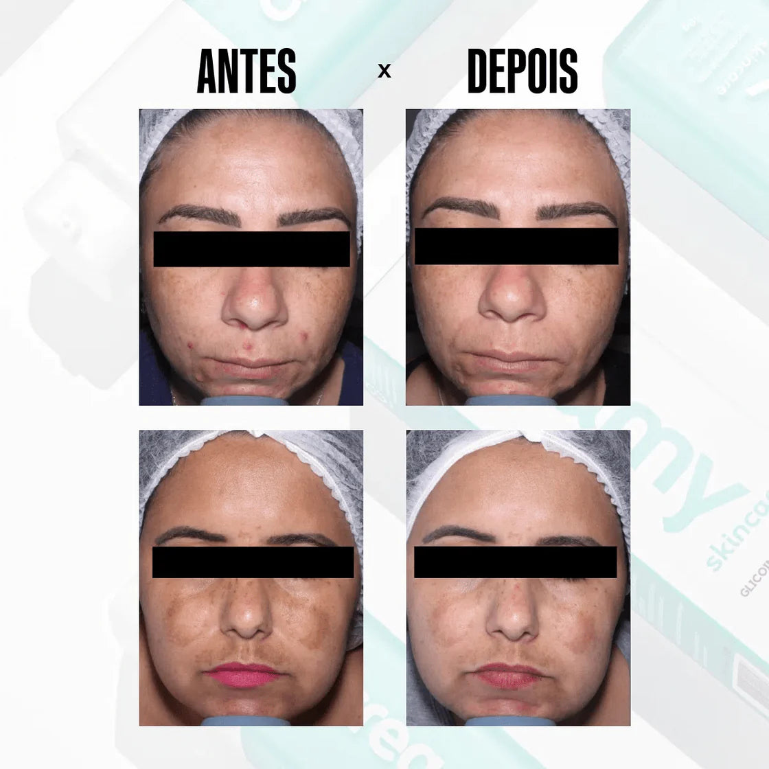 Glicointense Peel